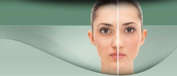 Elma Sirkesi Yüz Maskesi Tarifi ve Malzemeleri Elma Sirkesi Yüz Maskesi Tarifi ve Malzemeleri